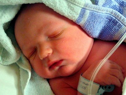 А киста в главата на съдово образуване сплит новородено бебе субепендимални