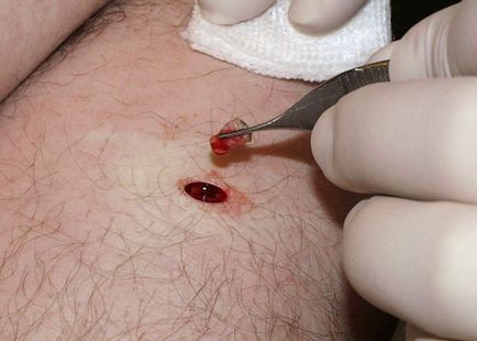 Червени родилни петна - тяло, на причините за сигнални опасни заболявания, фото