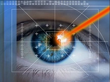 Лазерната корекция на зрението в Москва - клиника