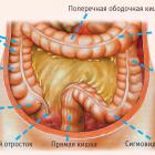 Лечение на основни заболявания на тънките черва