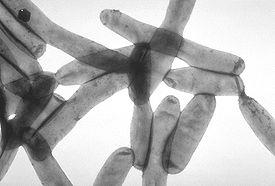 Killer Legionella във водните системи
