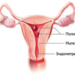 Млечница при жените, симптоми и лечение на млечница