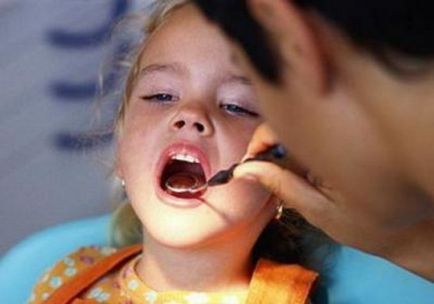 Дали сребърни зъби от кариес при деца