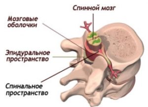 Предистория и предвестници на инсулт при жените и мъжете