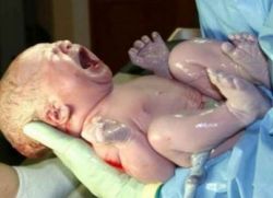 Пробиви с пикочния мехур по време на раждане