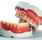 Протези и възстановяване на зъбите, разумни цени в град София - стоматология 