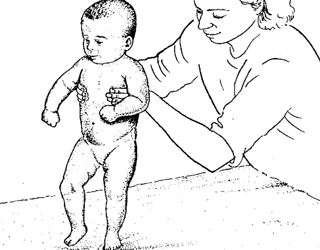 Синдроми, разстройства, двигателни нарушения () в новородени