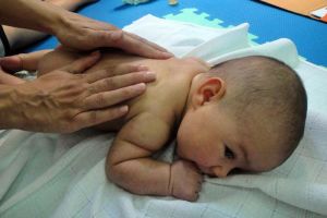 Синдроми, разстройства, двигателни нарушения () в новородени