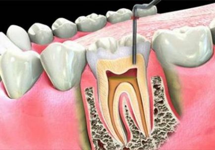 Колко канали в зъба