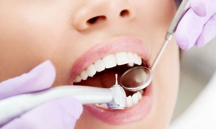 Мечта за стоматология за избелване, премахване запечата или вграждане изкуствен