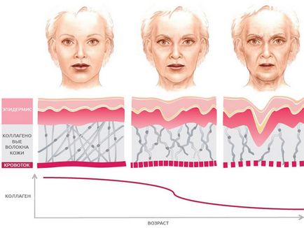 Стареене на кожата при жените основната причина, процедурите за изследване салон, данни снимка