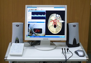 Транскраниална Доплер церебрална съдови указания и техника на