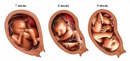Третият ултразвук по време на бременност, по всяко време, 3 ултразвук по време на бременност