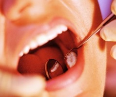 Премахване на зъба, които правят грижата за раните, болката не изчезва, протезата