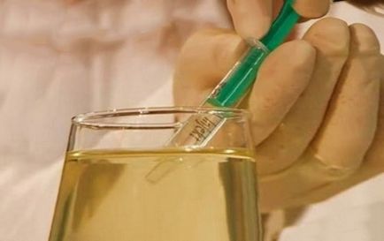 Урината прилагане на урина в медицината, тялото прочистване здраве