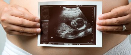 Узи да се определи началото на бременността
