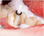 Отглеждане зъби в човешки мит или бъдещи технологии