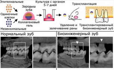 Отглеждане зъби в човешки мит или бъдещи технологии