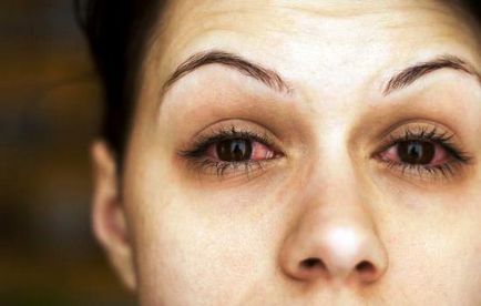 Възпаление на клепача симптомите на очите, причините, заболяването може да