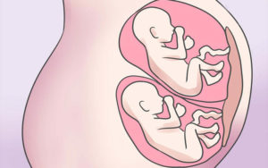 Бременност с близнаци, както се оказва, как да се идентифицират