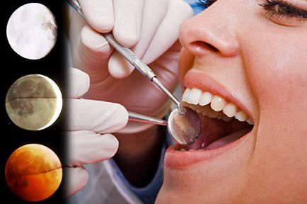 Благоприятни дни за лечение на зъбите съгласно лунен календар през 2017 г.