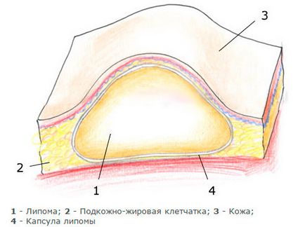 Какво е Уен и колко е опасно, традиционните методи на лечение, народни средства за защита, снимки