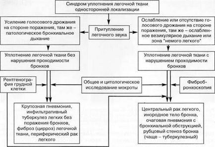 Диагностика, диференциална диагноза и лечение на синдрома на белодробен паренхим компресия