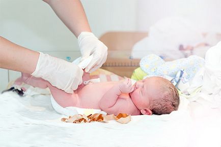 Как за лечение на новородено пъпа Zelenko