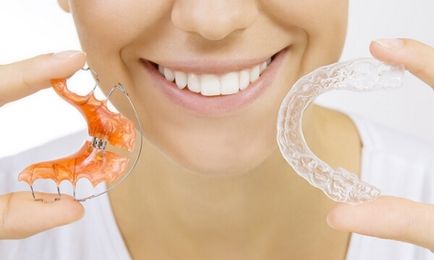 Как да се съгласуват зъбите без презрамки, които могат да бъдат използвани у дома