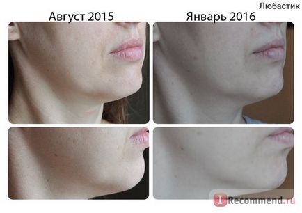 Lifting Cream - Овалния кора моделиране грижа за лицето и брадичката - 