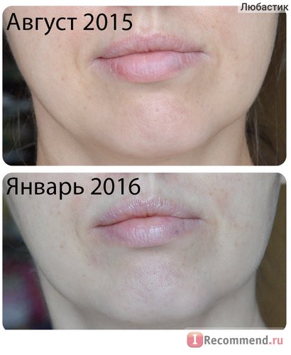 Lifting Cream - Овалния кора моделиране грижа за лицето и брадичката - 
