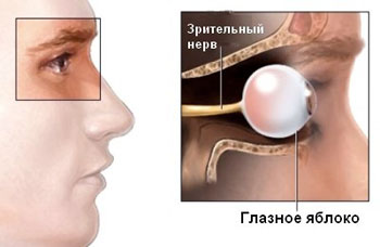 Неврит на зрителния нерв симптоми, лечение и видове очни неврит