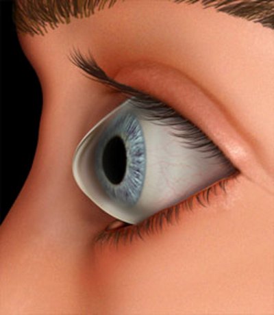 Причини и лечение на кератоконус очи