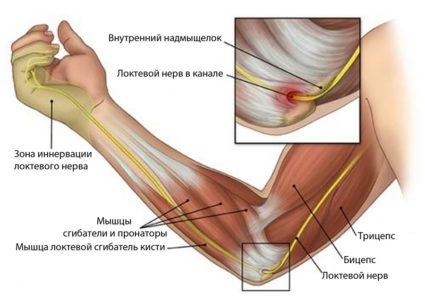 Ако лечението на болки в ръката