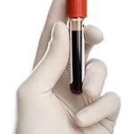Rapid описание кръвен тест, видове и техните характеристики