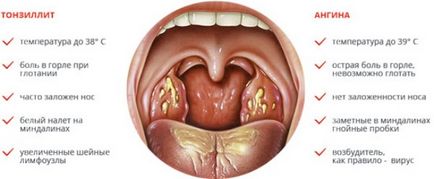 Как да се отървем от буцата в гърлото