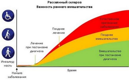 А симптом на множествена склероза