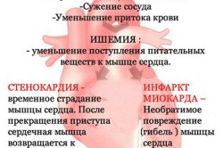Хронична коронарна недостатъчност какво е Хронична коронарна недостатъчност какво е
