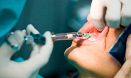 Анестезия в стоматологията, което се случва, е видяна
