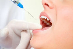 Анестезия стоматология
