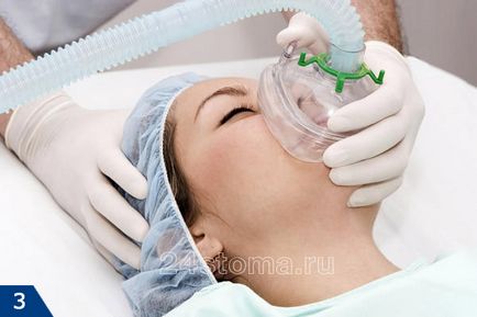 Анестезия стоматология ubistezin, septanest, skandonest - инструкции за употреба, ревюта, цена