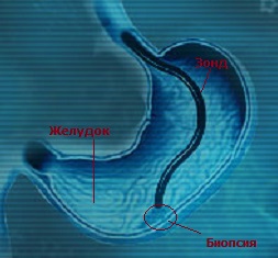 Биопсия на това, което е