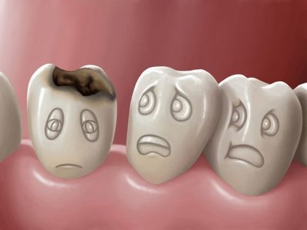Как да премахнете зъбобол у дома какво да правите, ако имате зъбобол, семейство и майка
