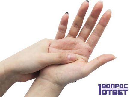 Сърбеж дясната длан в това, което предвещава, че сърбеж дясна ръка, което може да се надраска дясна ръка