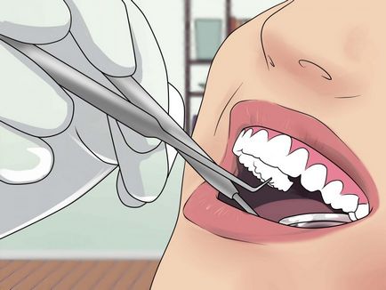 Какво става, ако много силен зъбобол се отървете от зъбобол