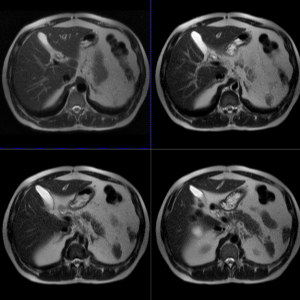 MRI показва, че коремната кухина с подготовка за разлика от кои органи проверяват цена