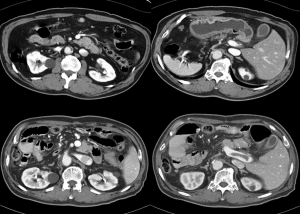 MRI показва, че коремната кухина с подготовка за разлика от кои органи проверяват цена