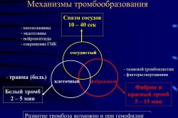 Това, което е образуване на кръвен съсирек причини, симптоми и лечение