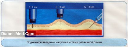 Правя инсулин Правя инсулин