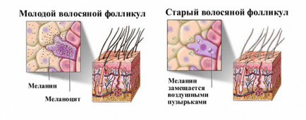 Ефективни народни средства за сива коса